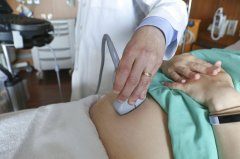 美国女性因怀孕死亡人数增多 大部分疾病可预防