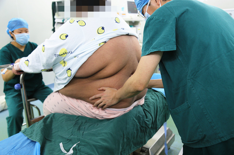 300多斤孕妇顺利分娩 专家：孕产妇要建立体重管理意识