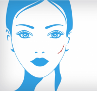 618开门红,芭克畅销的背后,关注疤痕人群的“身心”健康!